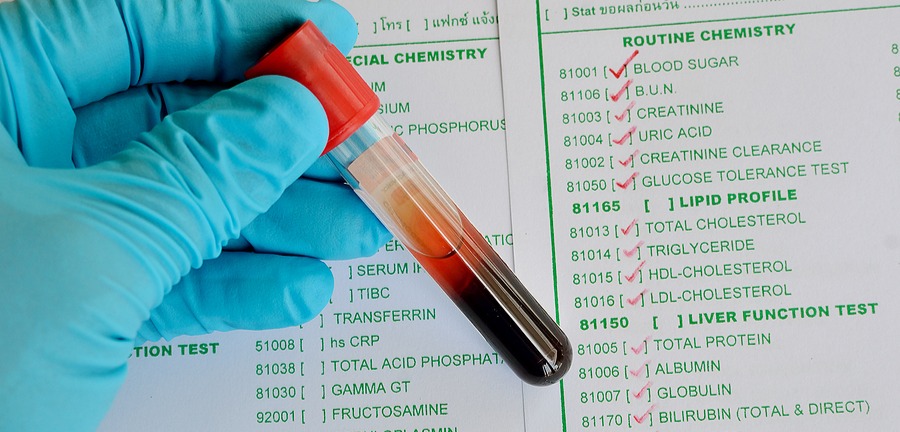 Supporting figure for African American Kidneys: Why is race used to measure kidney function?
